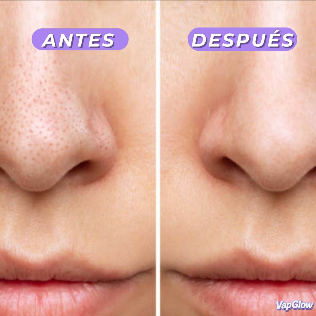 Limpiador Facial de Vapor | Mantén tu Piel Limpia en Minutos