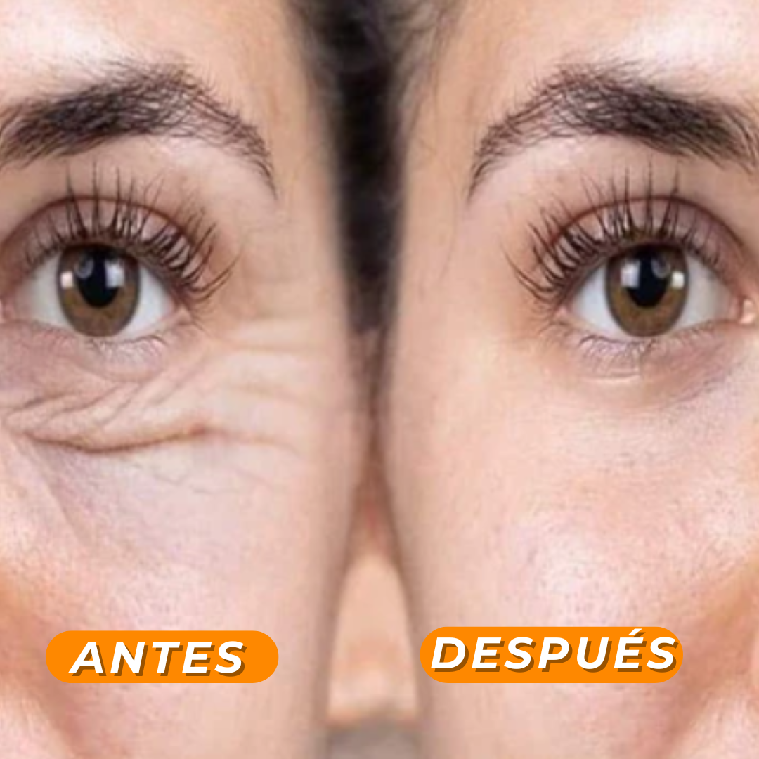 Crema Reafirmante | Elimina Bolsas y Ojeras (Lleva 3 Paga 1)