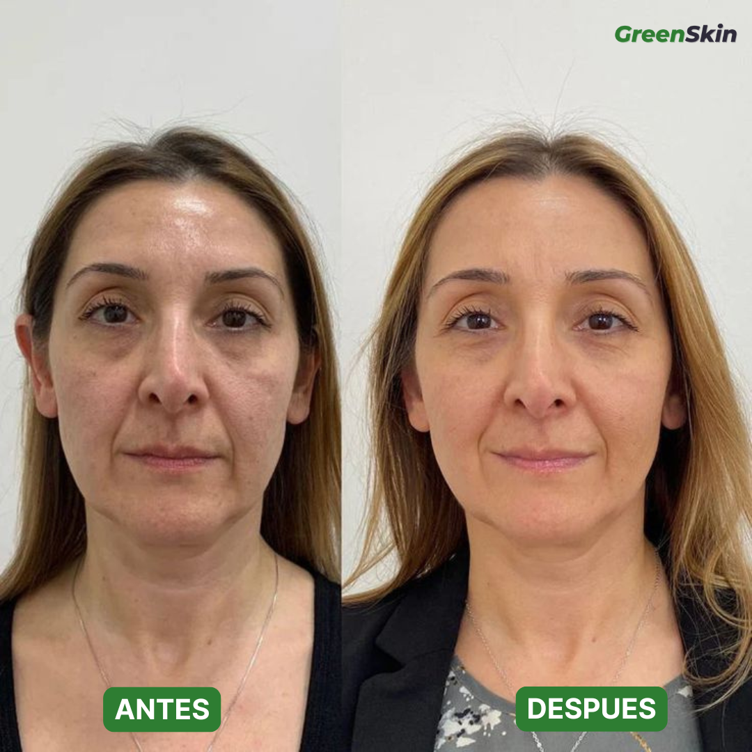 Mascarilla Purificante de Cáñamo | Limpia Poros y Restaura Luminosidad (Lleva 2 Paga 1)