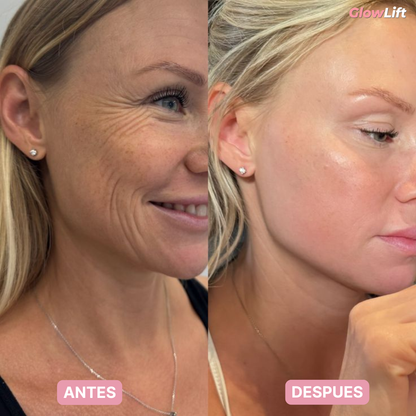 Masajeador Facial | Reafirma y Rejuvenece la Piel