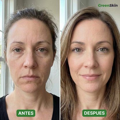 Mascarilla Purificante de Cáñamo | Limpia Poros y Restaura Luminosidad (Lleva 2 Paga 1)