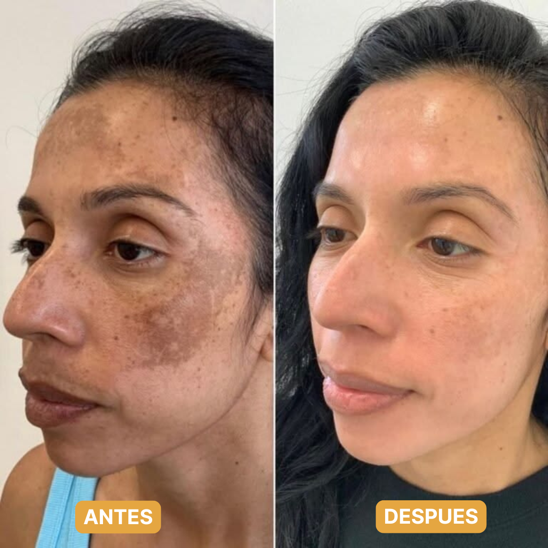 Vitamina C Antioxidante | Aclara Manchas y Pareja el Tono (Lleva 2 Paga 1)