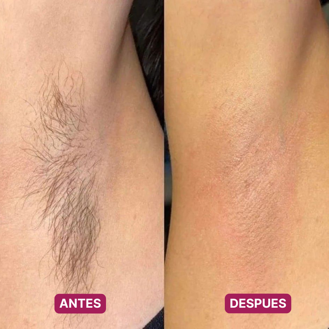 Afeitadora Eléctrica 2 en 1 · Sin Foliculitis ni Ronchas, Hasta en Zonas Delicadas (Lleva 2 Paga 1)