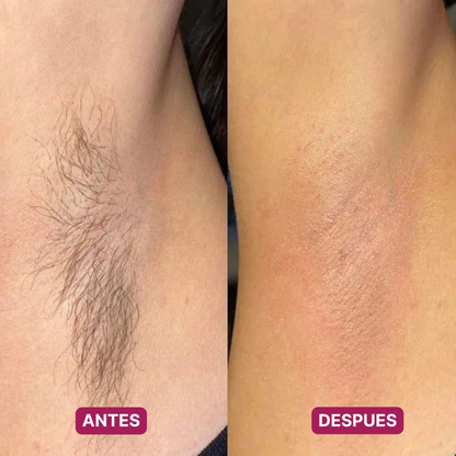 Afeitadora Eléctrica 2 en 1 · Sin Foliculitis ni Ronchas, Hasta en Zonas Delicadas (Lleva 2 Paga 1)