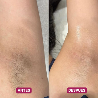 Afeitadora Eléctrica 2 en 1 · Sin Foliculitis ni Ronchas, Hasta en Zonas Delicadas (Lleva 2 Paga 1)