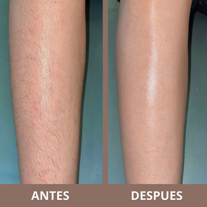 Aceite Inhibidor de Vello | Frena el Crecimiento del Vello Corporal (Lleva 2 Paga 1)