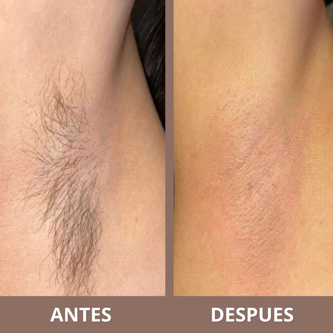 Aceite Inhibidor de Vello | Frena el Crecimiento del Vello Corporal (Lleva 2 Paga 1)