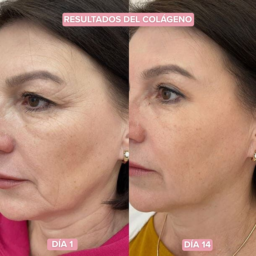 Loción Facial Colágeno | Recupera el brillo natural de tu piel (Lleva 2 Paga 1)