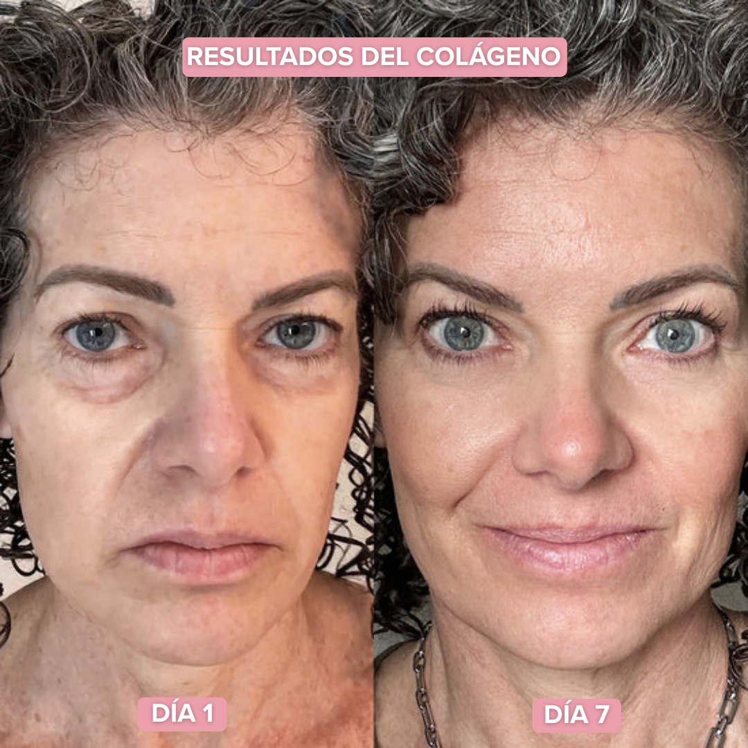Loción Facial Colágeno | Recupera el brillo natural de tu piel (Lleva 2 Paga 1)