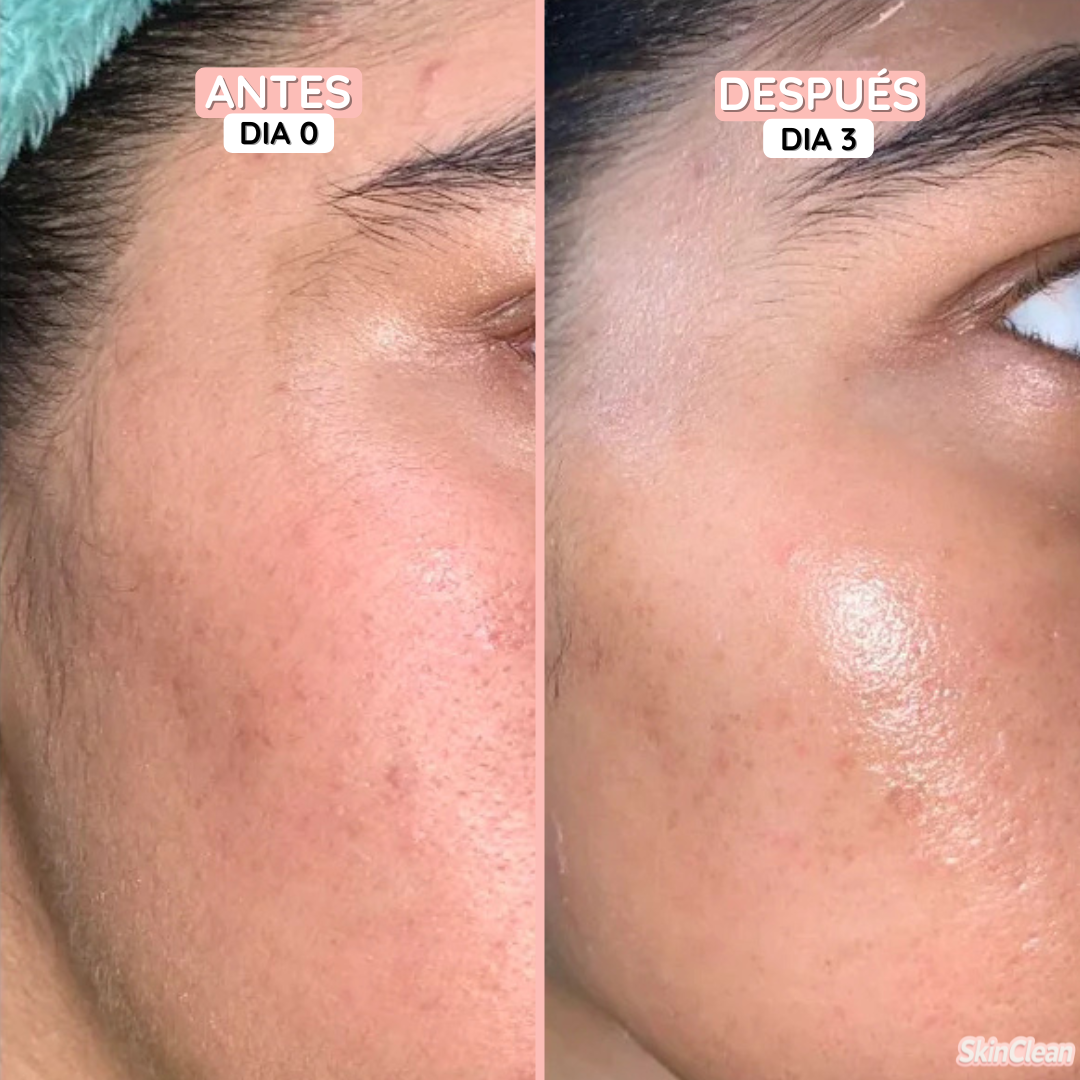 Crema Depilatoria | Elimina el Vello Facial (Lleva 2 Paga 1)