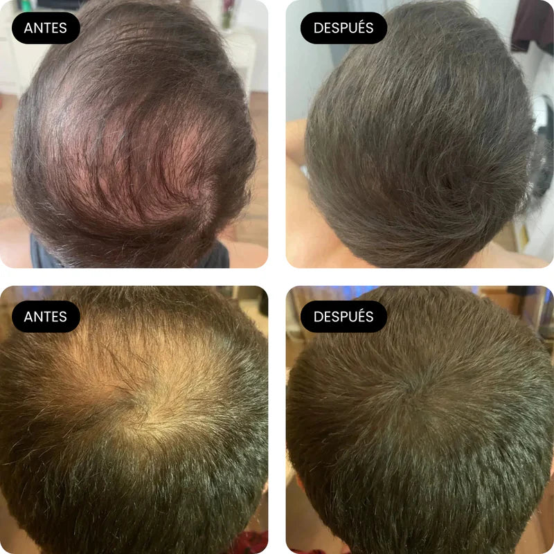 Polvo Relleno Capilar | Rellena Calvicie, Entradas y Pelones (Lleva 2 Paga 1)